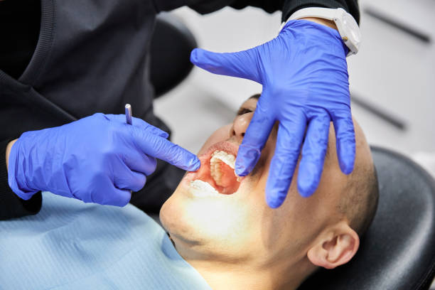 Best Emergency Tooth Extraction in Feather Sound, FL